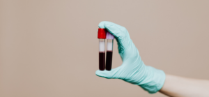 Darstellung von abgenommenen Blut Phiolen